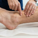 Conquering Ankle and Foot Injuries with Physiotherapy